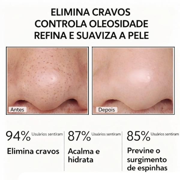 Lanbena Removedor de Cravos 30g + 60 Pcs Papel Normal Máscara Facial Lambena Lançamento