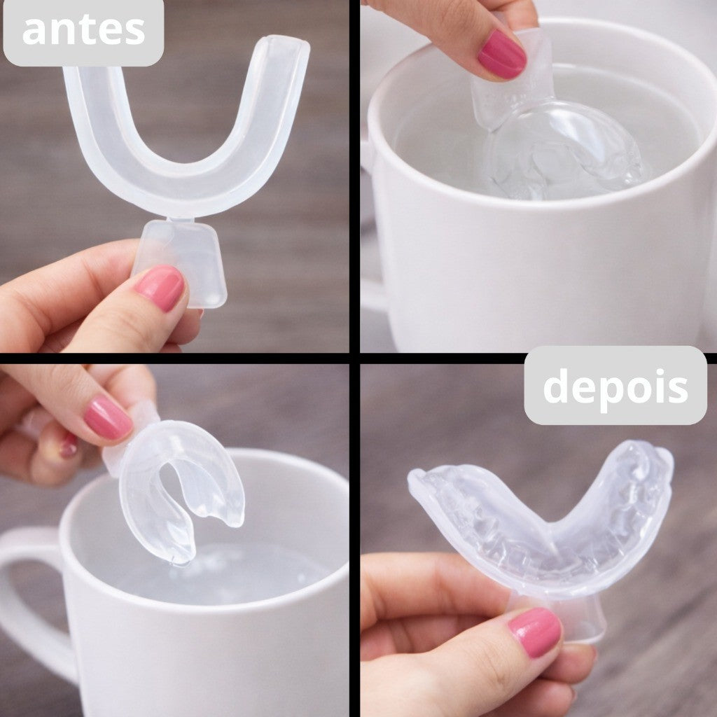 Protetor Bucal Moldávavel - Bruxismo Silicone Moldável 4 Placas Dormir Dentes